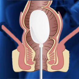 Manometría anorrectal